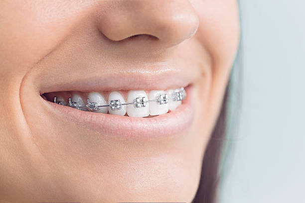 Best Teeth Whitening  in Black Hammock, FL